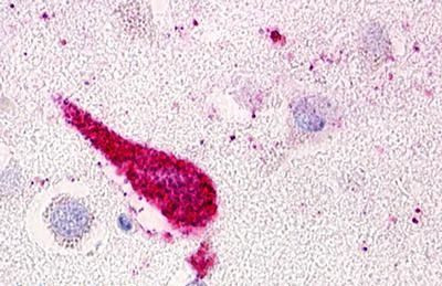 GPRC5D Antibody in Immunohistochemistry (Paraffin) (IHC (P))