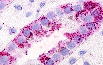 GPRC5D Antibody in Immunohistochemistry (Paraffin) (IHC (P))