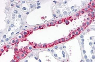 ADAMTS4 Antibody in Immunohistochemistry (Paraffin) (IHC (P))