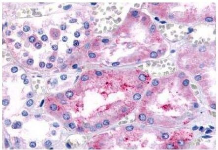 PTGER4 Antibody in Immunohistochemistry (Paraffin) (IHC (P))