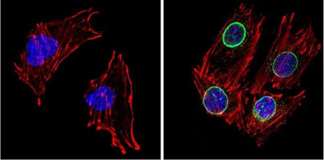 LXR beta Antibody in Immunocytochemistry (ICC/IF)