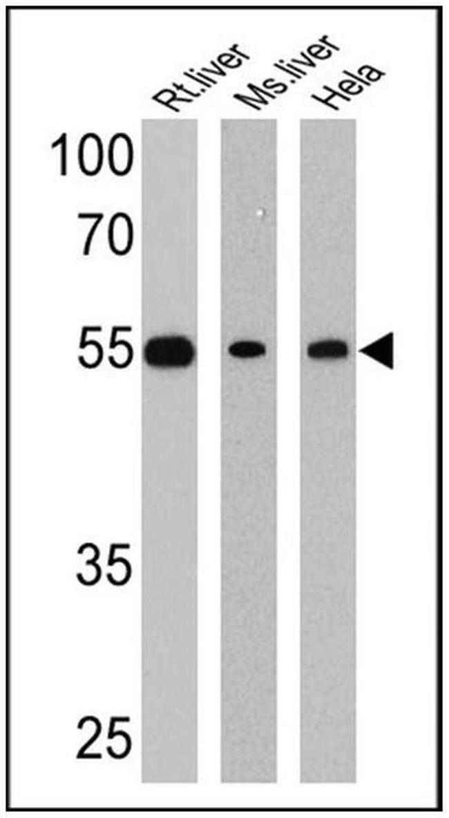 LXR beta Antibody in Western Blot (WB)