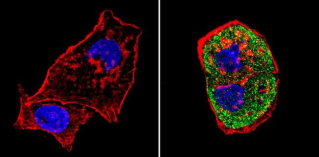 SREBP1 Antibody in Immunocytochemistry (ICC/IF)