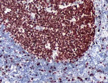 Ki-67 Antibody in Immunohistochemistry (Paraffin) (IHC (P))