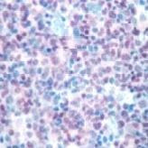 PAX5 Antibody in Immunohistochemistry (Paraffin) (IHC (P))