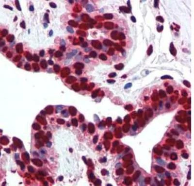 Histone H2A.X Antibody in Immunohistochemistry (Paraffin) (IHC (P))