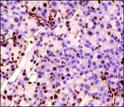 MECP2 Antibody in Immunohistochemistry (Paraffin) (IHC (P))