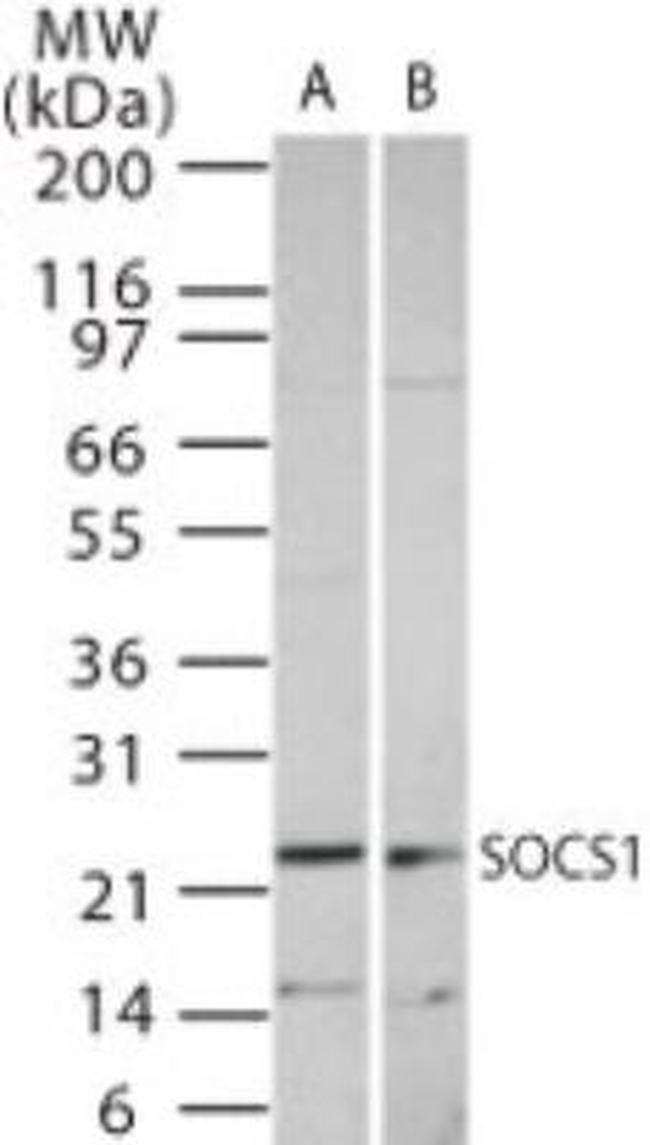 SOCS1 Antibody in Western Blot (WB)