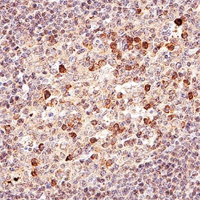 NOXA Antibody in Immunohistochemistry (Paraffin) (IHC (P))