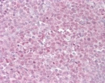 TRF2 Antibody in Immunohistochemistry (Paraffin) (IHC (P))