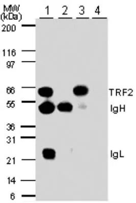 TRF2 Antibody in Immunoprecipitation (IP)