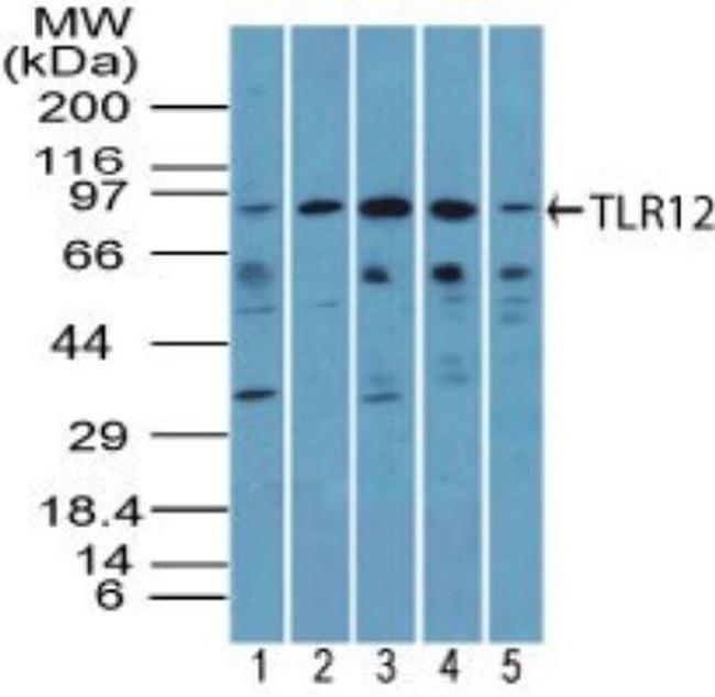 TLR12 Antibody in Western Blot (WB)