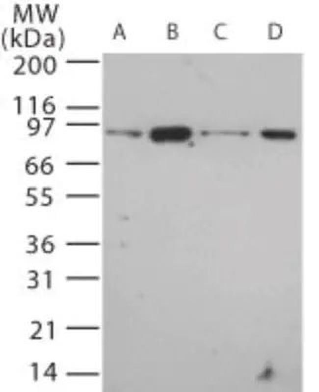TLR12 Antibody in Western Blot (WB)