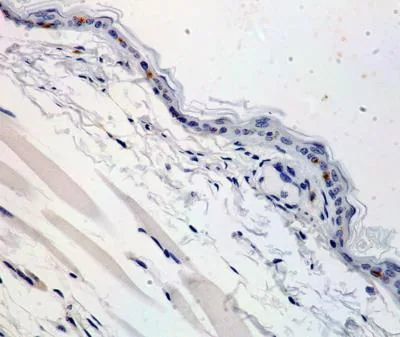 Langerin Antibody in Immunohistochemistry (Paraffin) (IHC (P))