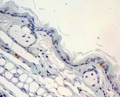 Langerin Antibody in Immunohistochemistry (Paraffin) (IHC (P))