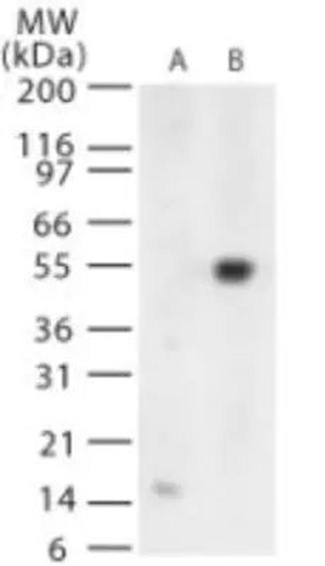 West Nile Virus Envelope Antibody in Western Blot (WB)