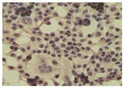 CYLD Antibody in Immunocytochemistry (ICC/IF)