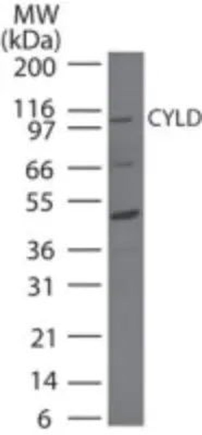 CYLD Antibody in Western Blot (WB)