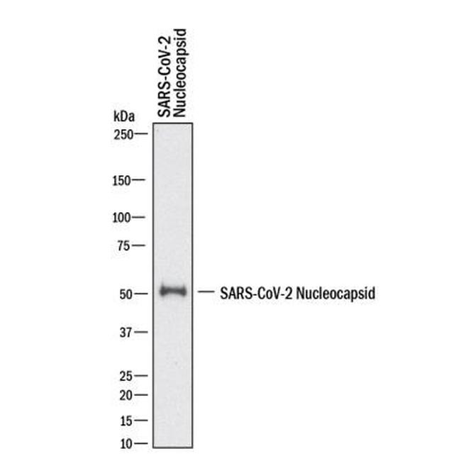 SARS Coronavirus Nucleocapsid Antibody in Western Blot (WB)