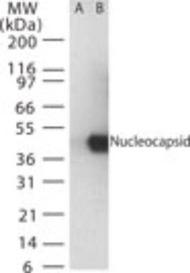 SARS Coronavirus Nucleocapsid Antibody in Western Blot (WB)