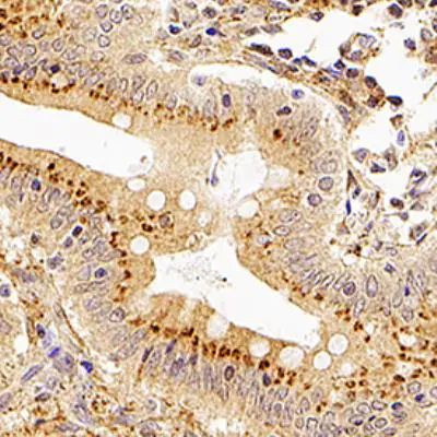 XAF1 Antibody in Immunohistochemistry (Paraffin) (IHC (P))