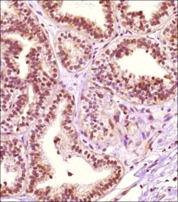 PRMT4 Antibody in Immunohistochemistry (Paraffin) (IHC (P))