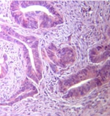 TLR5 Antibody in Immunohistochemistry (Paraffin) (IHC (P))