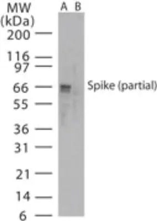 SARS Coronavirus Spike Protein Antibody in Western Blot (WB)