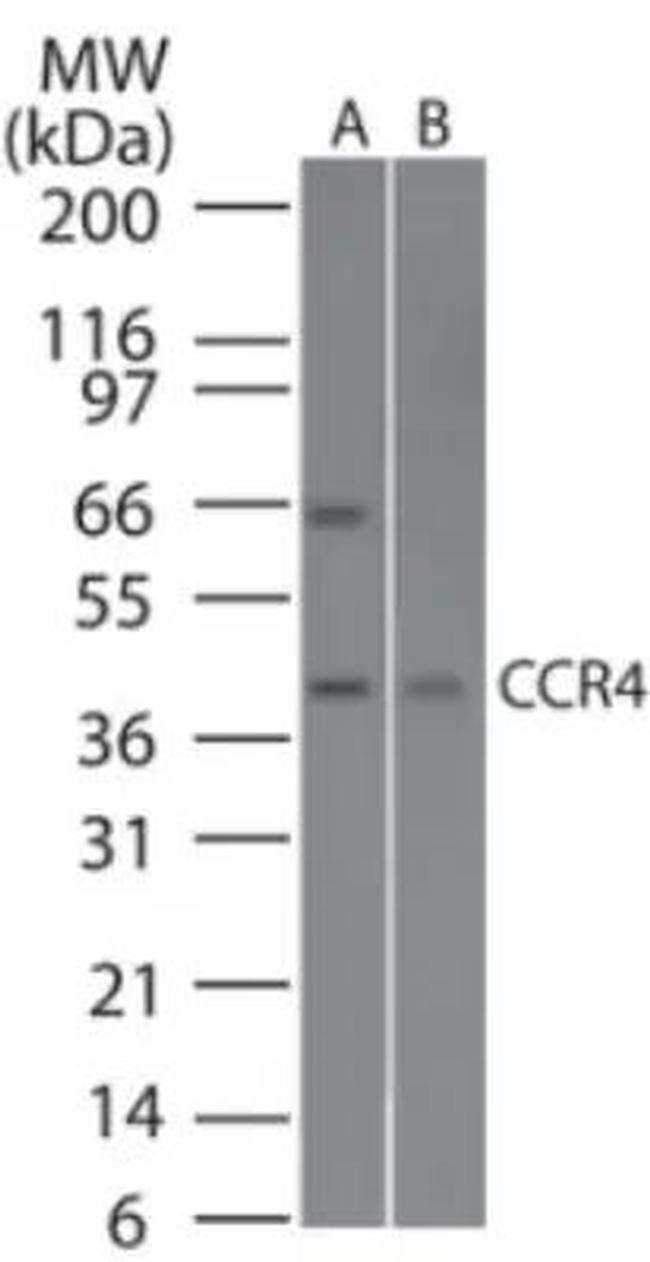 CCR4 Antibody in Western Blot (WB)