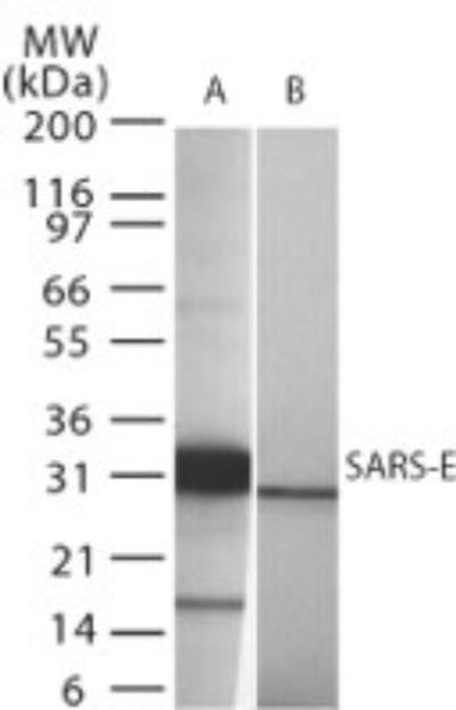SARS Envelope Protein Antibody in Western Blot (WB)
