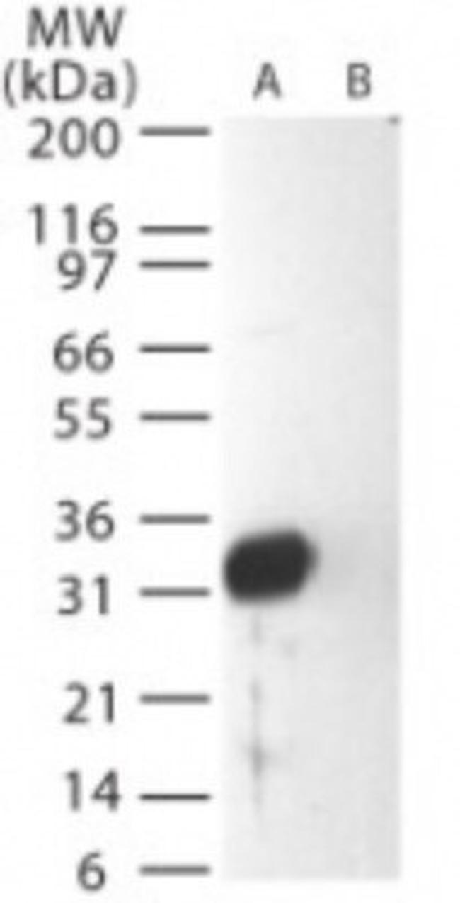 SARS Coronavirus Matrix Antibody in Western Blot (WB)