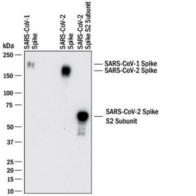 SARS Coronavirus Spike Protein Antibody in Western Blot (WB)
