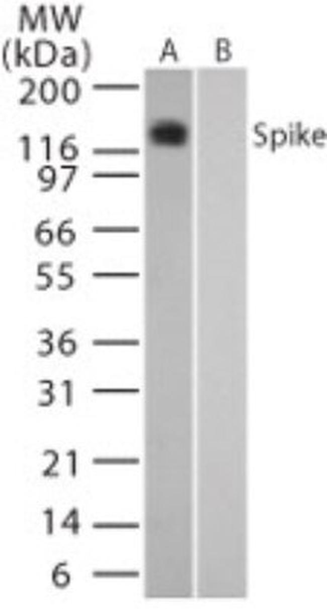 SARS Coronavirus Spike Protein Antibody in Western Blot (WB)