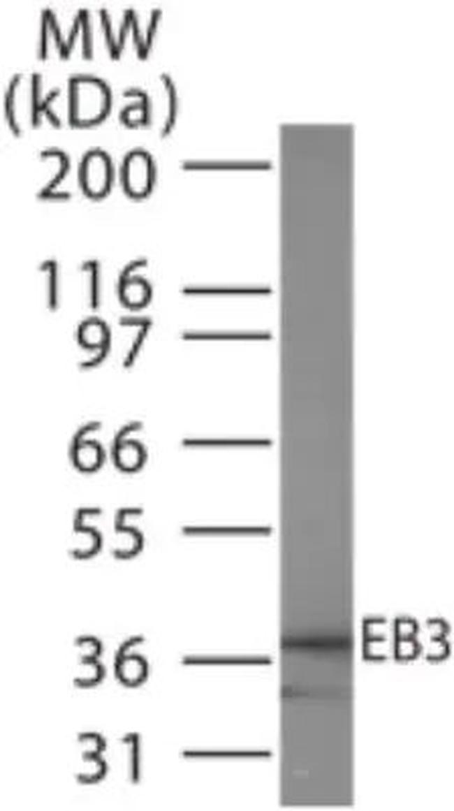 MAPRE3 Antibody in Western Blot (WB)