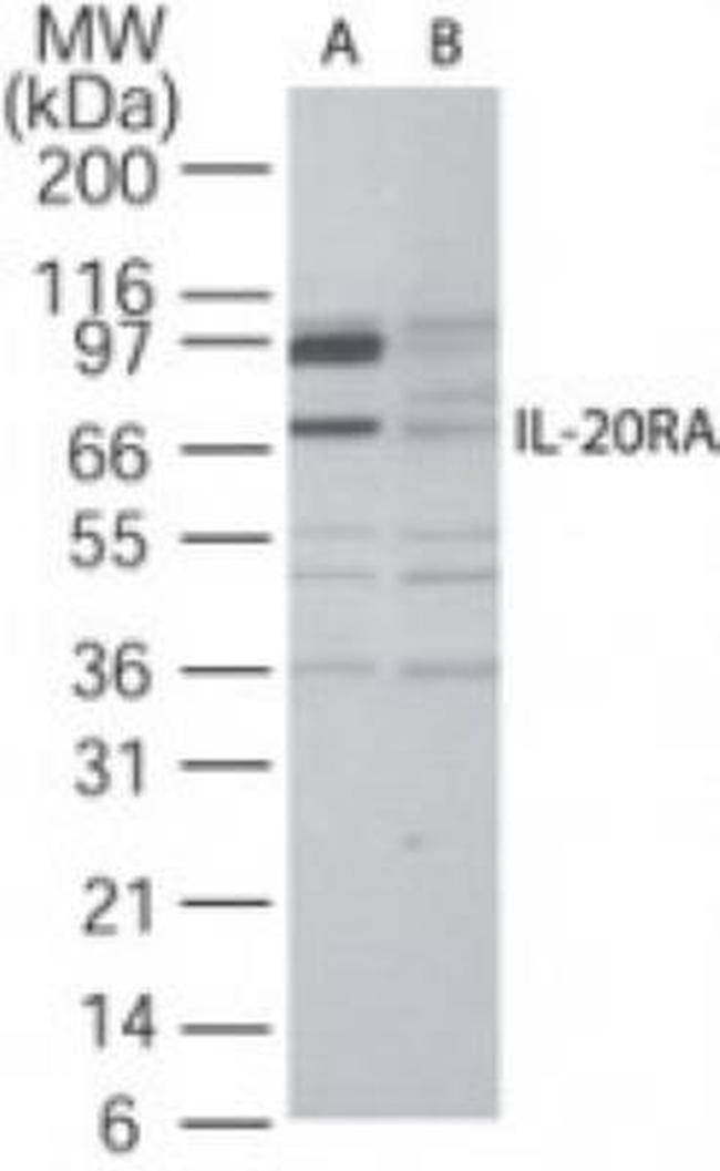 IL20RA Antibody in Western Blot (WB)