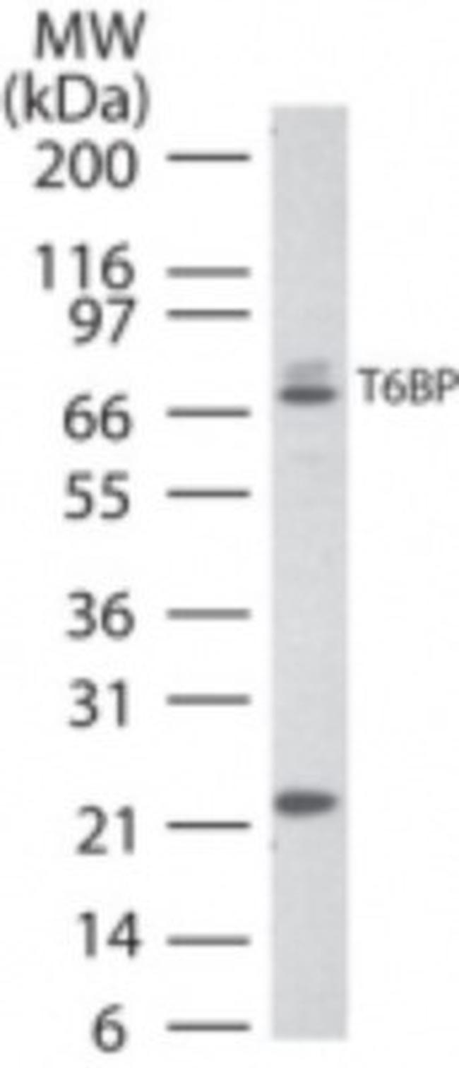 TAX1BP1 Antibody in Western Blot (WB)