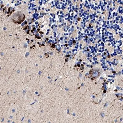 TRAIL-R2 (DR5) Antibody in Immunohistochemistry (Paraffin) (IHC (P))