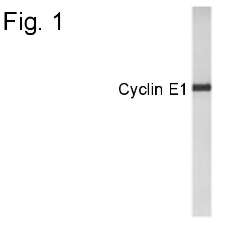 Cyclin E Antibody in Western Blot (WB)