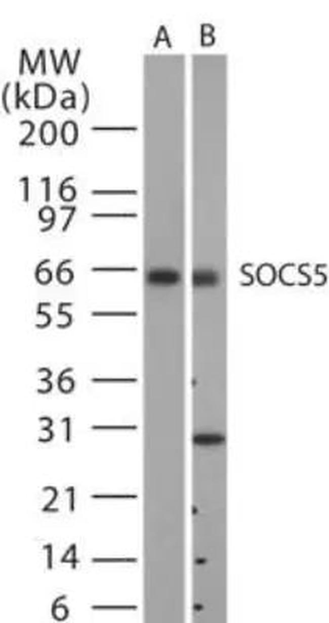 SOCS5 Antibody in Western Blot (WB)