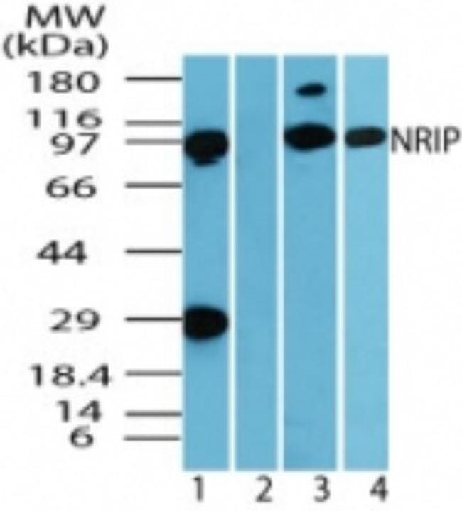 DCAF6 Antibody in Western Blot (WB)