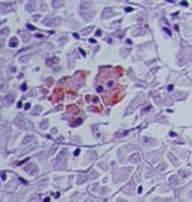 SENP2 Antibody in Immunohistochemistry (Paraffin) (IHC (P))