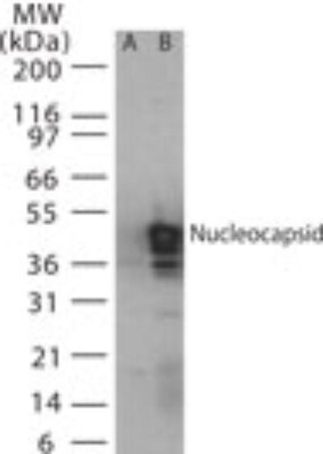 SARS Coronavirus Nucleocapsid Antibody in Western Blot (WB)