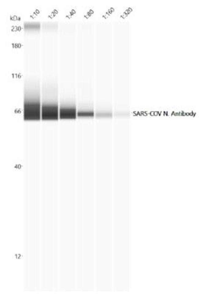 SARS Coronavirus Nucleocapsid Antibody in Western Blot (WB)