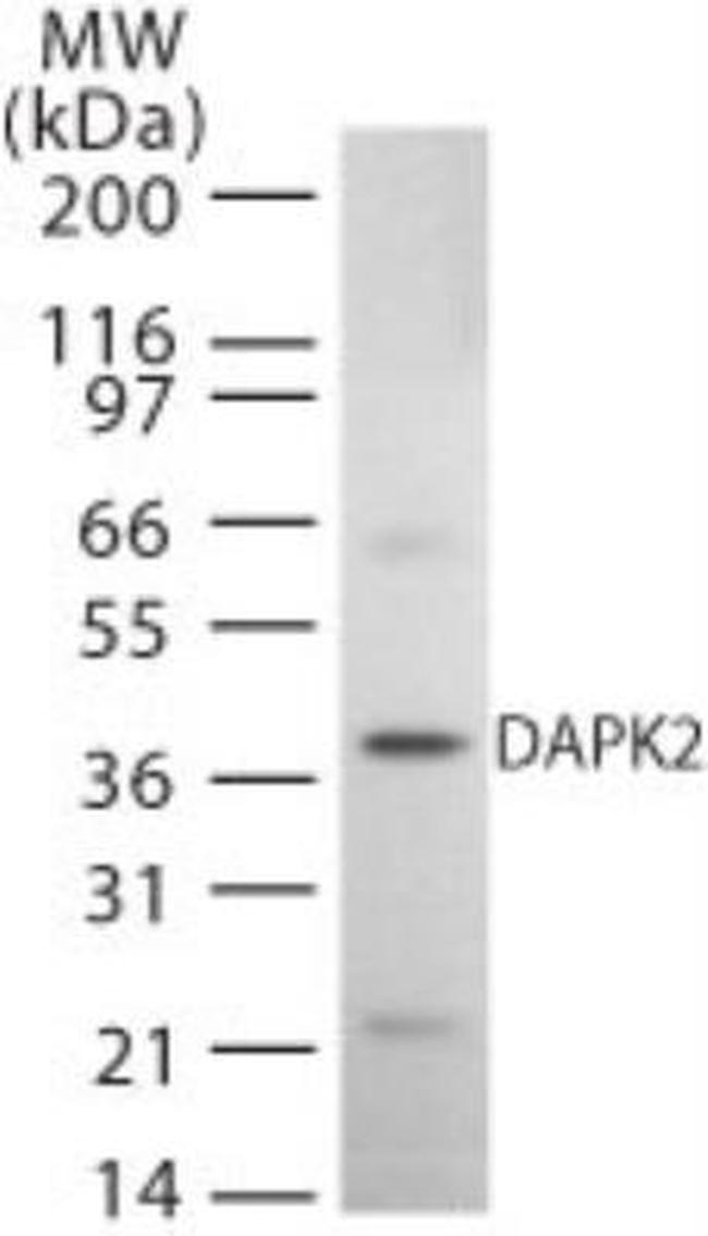 DAPK2 Antibody in Western Blot (WB)