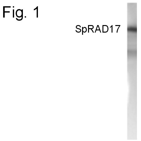 RAD17 Antibody in Western Blot (WB)