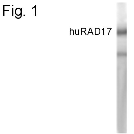 RAD17 Antibody in Western Blot (WB)
