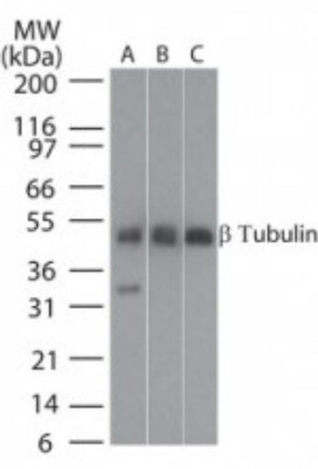 beta Tubulin Antibody in Western Blot (WB)