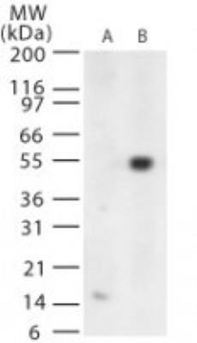 West Nile Virus Envelope Antibody in Western Blot (WB)