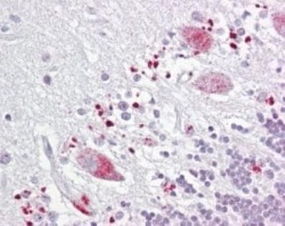 TIGAR Antibody in Immunohistochemistry (Paraffin) (IHC (P))