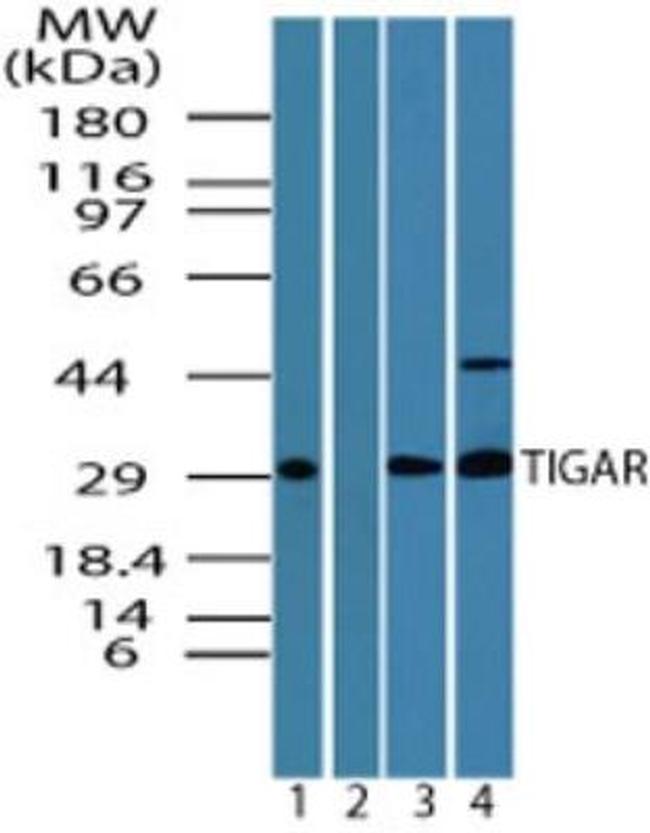 TIGAR Antibody in Western Blot (WB)